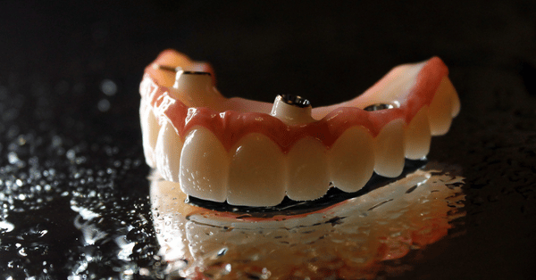implant dentist Glenview