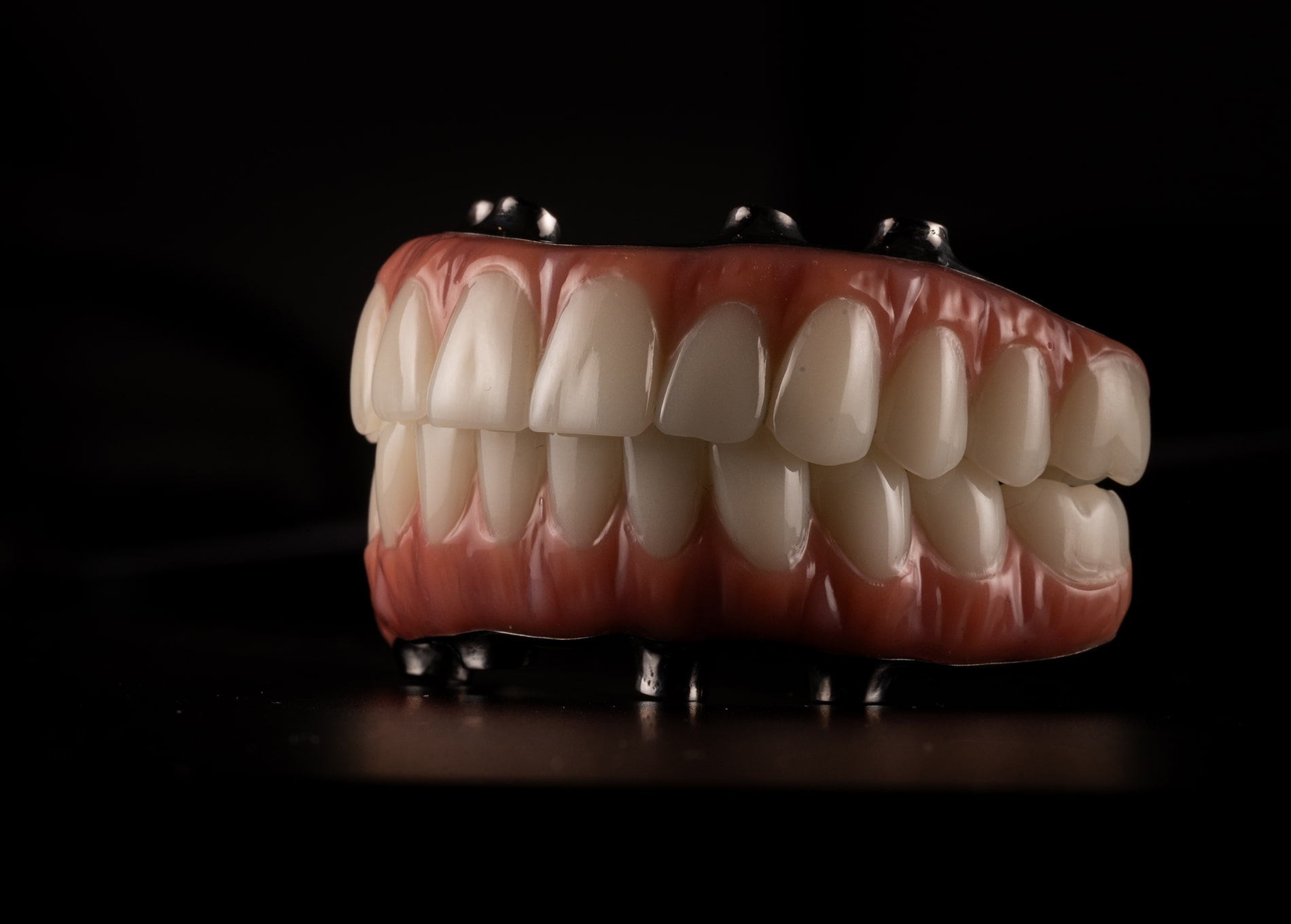 full mouth dental implants in Glenview